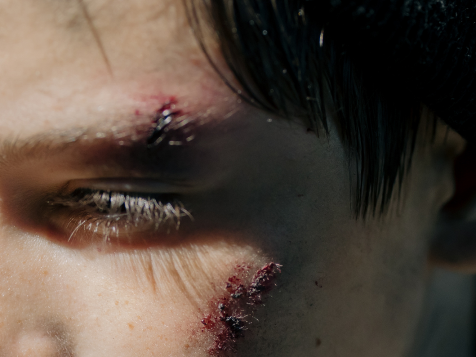 Visage portant les traces visibles d’une agression
