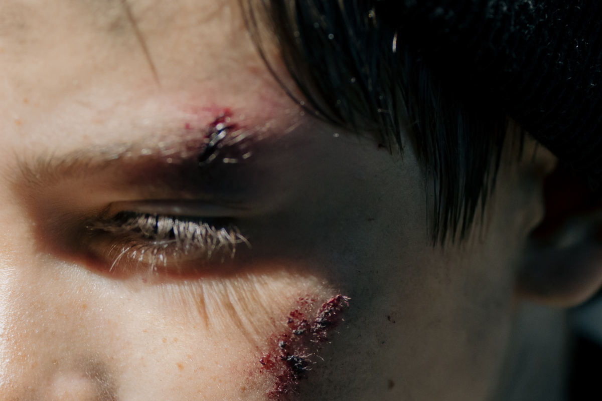 victimes-blessures-violences